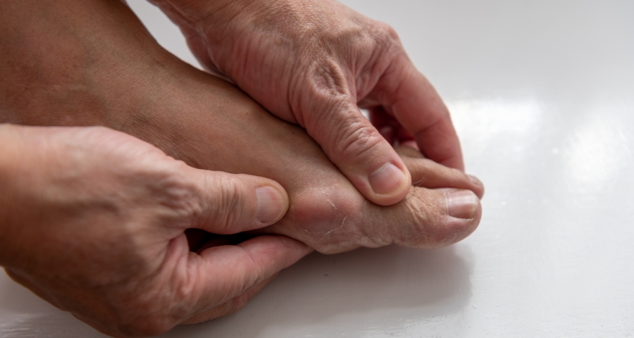 phan-biet-trieu-chung-benh-gut-voi-cac-benh-khac